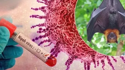 Bahaya Virus Nipah: Spektrum Gejala Berat dan Ancaman Kematian yang Perlu Diwaspadai