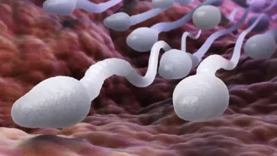 Kebiasaan Menurunkan Kualitas Sperma Pria, Hindari 7 Pemicu Ini